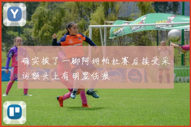确实挨了一脚阿姆帕杜赛后接受采访额头上有明显伤痕